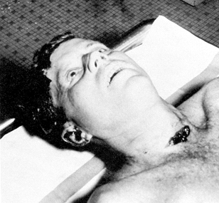 JFK autopsy photo